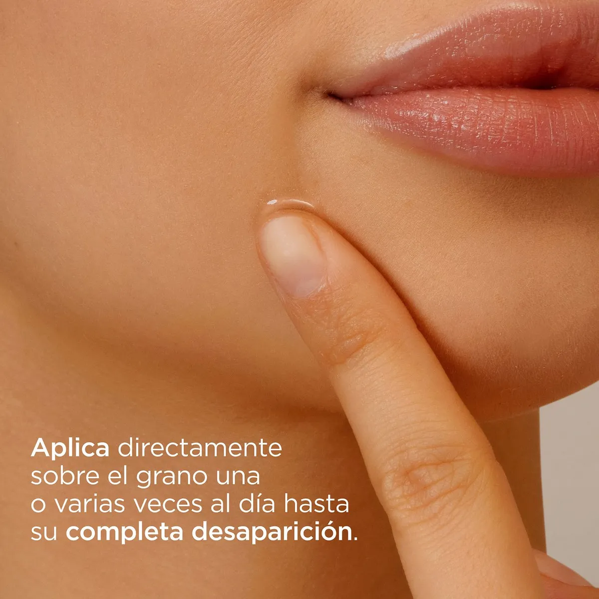ISDIN - ISDIN Acniben ON THE SPOT 15ML - Gel corrector de granos faciales localizados para piel grasa/tendencia acneica