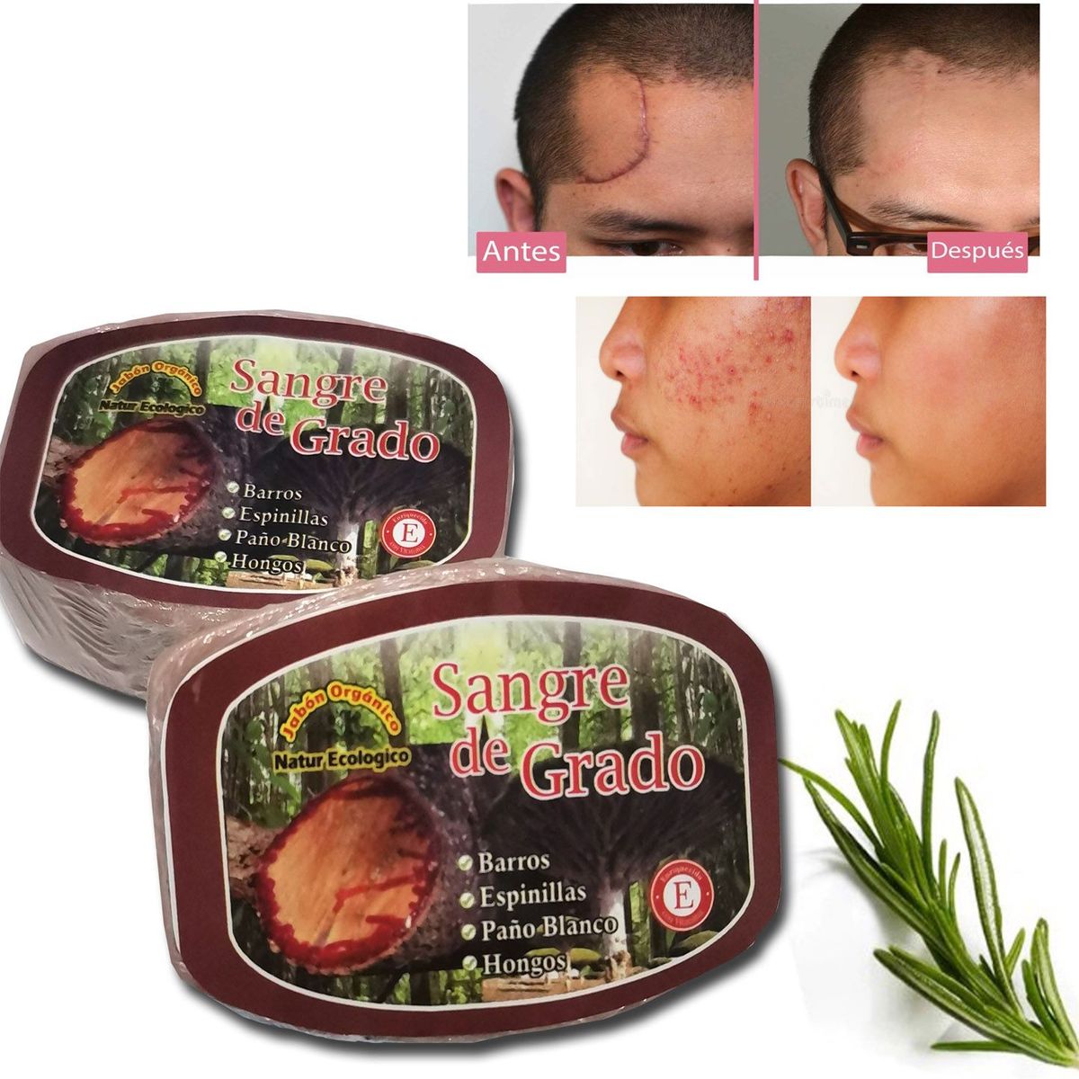 GENERICO - Jabón natural De Sangre Grado para acné