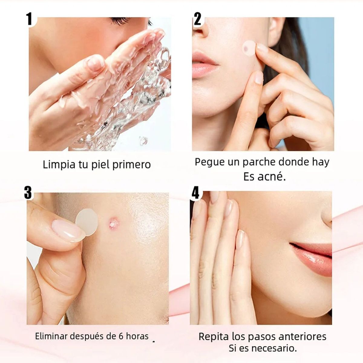 GENERICO - Parches tratamiento de Acné y espinillas SET 144 UND