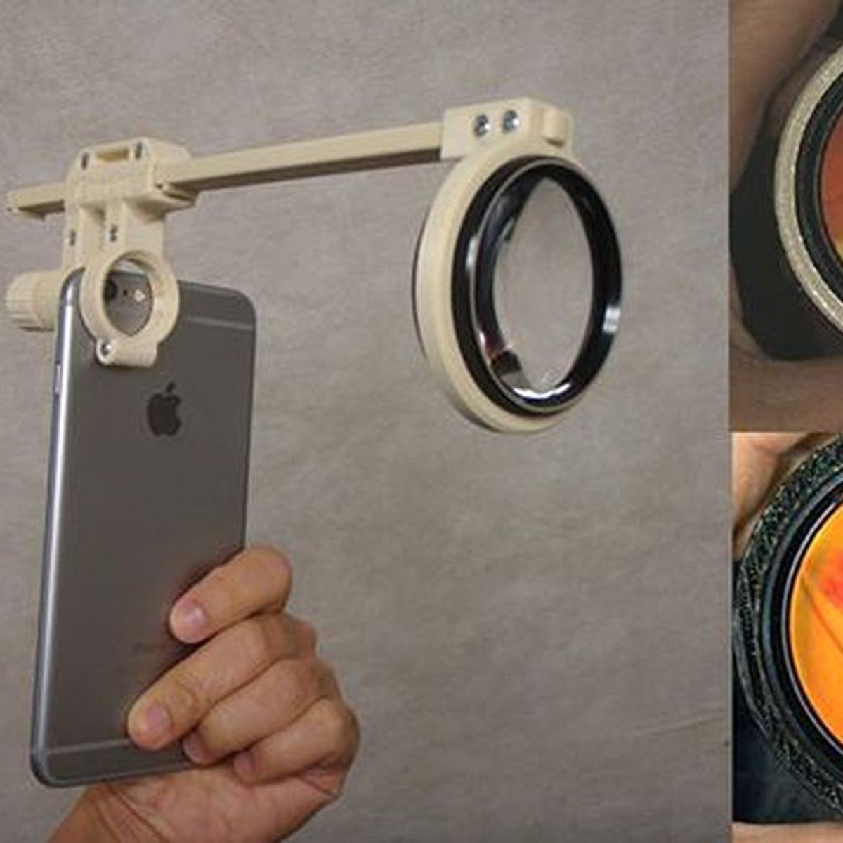 GENERICO - Oftalmoscopio Para Smartphone Elaborado Por Impresión 3d